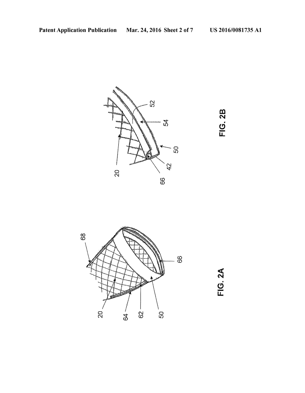 SYSTEMS AND METHODS FOR CRYOABLATION OF A TISSUE - diagram, schematic, and image 03