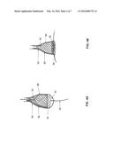 SYSTEMS AND METHODS FOR CRYOABLATION OF A TISSUE diagram and image