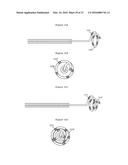 SYSTEM AND METHOD FOR MAPPING THE FUNCTIONAL NERVES INNERVATING THE WALL     OF ARTERIES, 3-D MAPPING AND CATHETERS FOR SAME diagram and image