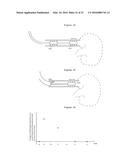 SYSTEM AND METHOD FOR MAPPING THE FUNCTIONAL NERVES INNERVATING THE WALL     OF ARTERIES, 3-D MAPPING AND CATHETERS FOR SAME diagram and image