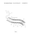 METHODS, SYSTEMS AND DEVICES FOR REDUCING THE LUMINAL SURFACE AREA OF THE     GASTROINTESTINAL TRACT diagram and image