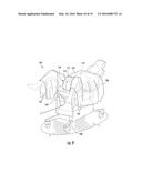 SURGICAL DRAPE FOR COLLECTING DISCHARGED FLUID diagram and image