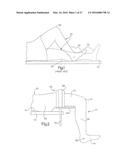 METHOD FOR PLACING IMPLANT USING ROBOTIC SYSTEM diagram and image