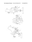 METHOD FOR PLACING IMPLANT USING ROBOTIC SYSTEM diagram and image