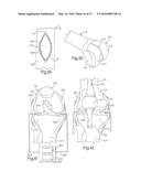 METHOD FOR PLACING IMPLANT USING ROBOTIC SYSTEM diagram and image