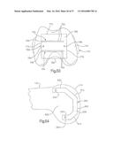 METHOD FOR PLACING IMPLANT USING ROBOTIC SYSTEM diagram and image