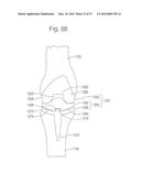 METHOD FOR PLACING IMPLANT USING ROBOTIC SYSTEM diagram and image