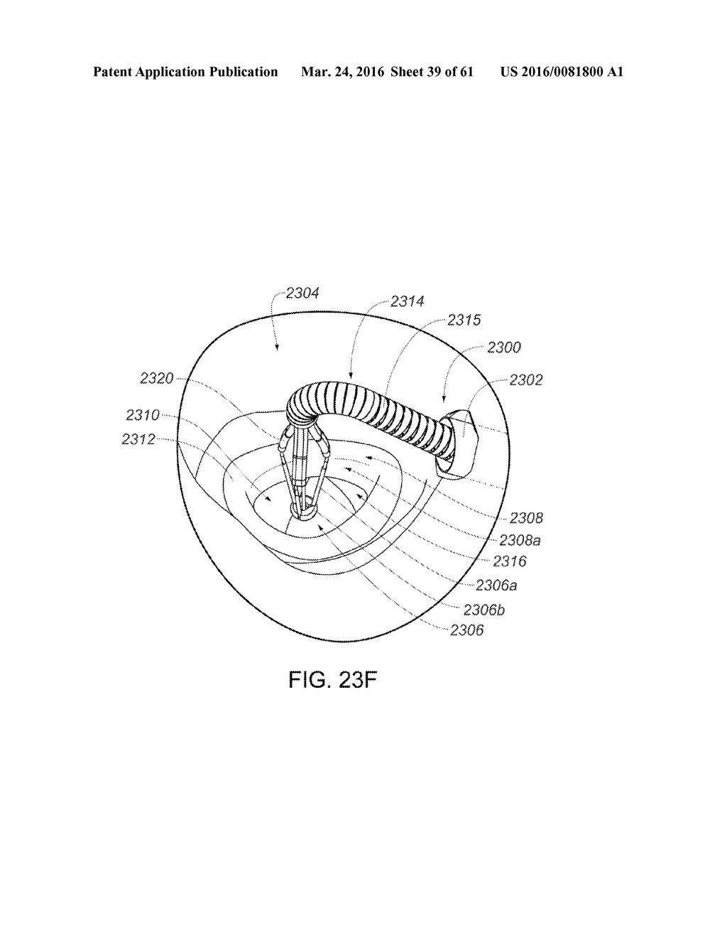 MEDICAL DEVICE, KIT AND METHOD FOR CONSTRICTING TISSUE OR A BODILY     ORIFICE, FOR EXAMPLE, A MITRAL VALVE - diagram, schematic, and image 40