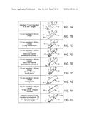 IMPLANTS FOR BONE FIXATION OR FUSION diagram and image