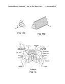 IMPLANTS FOR BONE FIXATION OR FUSION diagram and image