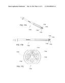 IMPLANTS FOR BONE FIXATION OR FUSION diagram and image