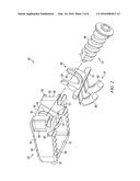 INTERVERTEBRAL DISC PROSTHESIS AND METHOD diagram and image