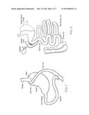 METHODS ALLOWING PYLORIC SPHINCTER TO NORMALLY FUNCTION FOR BARIATRIC     STENTS diagram and image