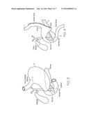 METHODS ALLOWING PYLORIC SPHINCTER TO NORMALLY FUNCTION FOR BARIATRIC     STENTS diagram and image