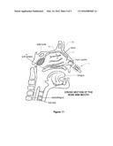 ANTI-SNORE NASAL MODULATOR diagram and image