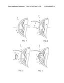 METHOD OF ALTERING THE REFRACTIVE PROPERTIES OF AN EYE diagram and image