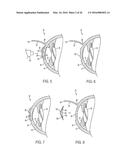 METHOD OF ALTERING THE REFRACTIVE PROPERTIES OF AN EYE diagram and image