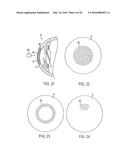 METHOD OF ALTERING THE REFRACTIVE PROPERTIES OF AN EYE diagram and image