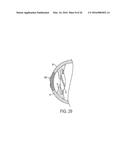 METHOD OF ALTERING THE REFRACTIVE PROPERTIES OF AN EYE diagram and image