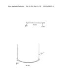 METHOD OF ALTERING THE REFRACTIVE PROPERTIES OF AN EYE diagram and image