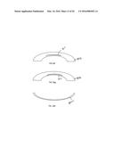 METHOD OF ALTERING THE REFRACTIVE PROPERTIES OF AN EYE diagram and image