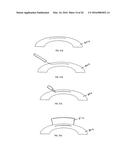 METHOD OF ALTERING THE REFRACTIVE PROPERTIES OF AN EYE diagram and image