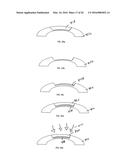 METHOD OF ALTERING THE REFRACTIVE PROPERTIES OF AN EYE diagram and image