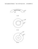 METHOD OF ALTERING THE REFRACTIVE PROPERTIES OF AN EYE diagram and image