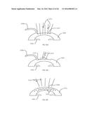 METHOD OF ALTERING THE REFRACTIVE PROPERTIES OF AN EYE diagram and image