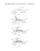 METHOD OF ALTERING THE REFRACTIVE PROPERTIES OF AN EYE diagram and image