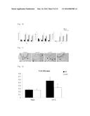 Composition Comprising AMD3100 For Preventing or Treating Bone Diseases diagram and image