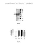 PHARMACOLOGICAL TREATMENT OF PARKINSON S DISEASE diagram and image