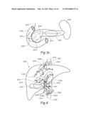 SYSTEMS AND METHODS FOR TREATING CANCER AND/OR AUGMENTING ORGAN FUNCTION diagram and image