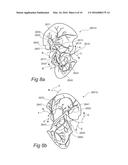 SYSTEMS AND METHODS FOR TREATING CANCER AND/OR AUGMENTING ORGAN FUNCTION diagram and image