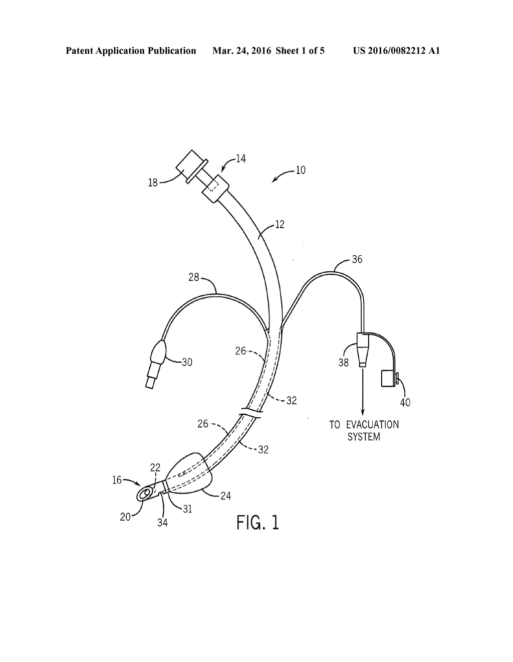 ENDOTRACHEAL TUBE WITH DEDICATED EVACUATION PORT - diagram, schematic, and image 02