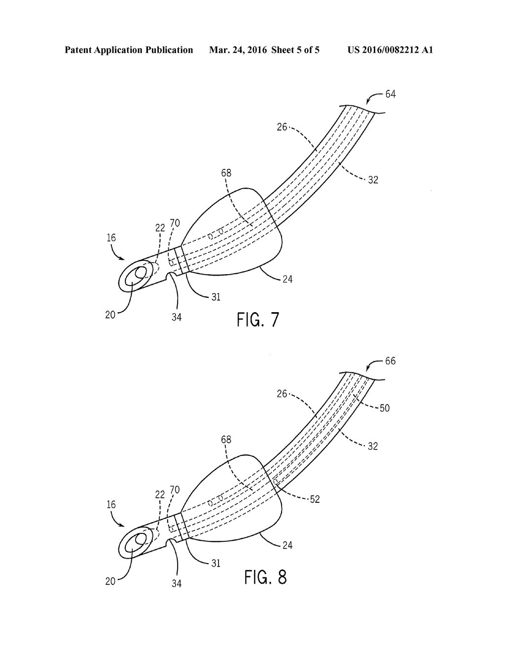 ENDOTRACHEAL TUBE WITH DEDICATED EVACUATION PORT - diagram, schematic, and image 06