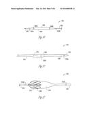 METHOD AND APPARATUS FOR PACING DURING REVASCULARIZATION diagram and image