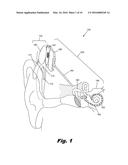 THIN PROFILE COCHLEAR IMPLANTS diagram and image