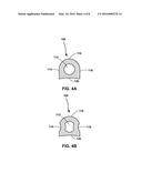 MEDICAL DEVICE FIXATION ATTACHMENT MECHANISM diagram and image