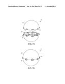 DIAGNOSTIC OR THERAPEUTIC PROCEDURE USING IMPLANTABLE TARGETS diagram and image