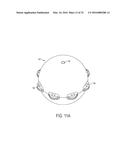 DIAGNOSTIC OR THERAPEUTIC PROCEDURE USING IMPLANTABLE TARGETS diagram and image