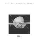 NEW TISSUE COMPENSATOR THICKNESS VISUALIZATION AND MODIFICATION TOOL FOR     USE IN RADIATION TREATMENT PLANNING diagram and image