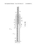 ULTRASONIC TREATMENT DEVICE diagram and image