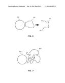 NANOPARTICLE TREATED FABRICS, FIBERS, FILAMENTS, AND YARNS AND RELATED     METHODS diagram and image