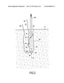 ANCHORING ASSEMBLY diagram and image