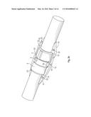 Fire Hose Girdle diagram and image