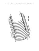 FLEXIBLE PIPE INCLUDING THERMAL INSULATION diagram and image