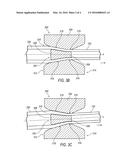 TUBULAR STRUCTURE SUPPORT WITH VARIABLE DIMENSIONS AND MECHANICAL     PROPERTIES diagram and image