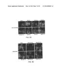 METHODS AND COMPOSITIONS FOR THE DIAGNOSIS OF CANCER SUSCEPTIBILITIES AND     DEFECTIVE DNA REPAIR MECHANISMS AND TREATMENT THEREOF diagram and image