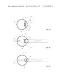 VISION MODIFICATION WITH REFLECTED IMAGE diagram and image